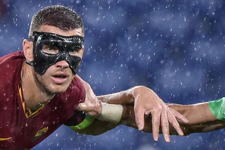 Masked Man Dzeko Can T See Very Well But Still Scores Besoccer