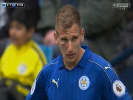 Albrighton acabó con todo el pómulo hinchado. SkySports