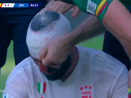 Le 'K.O.' technique de Higuain. Captura/Movistar