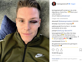 Après un choc violent contre la tête de Piqué. Instagram/kevingameirooff