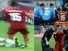 Klopp, optimistic about Oxlade-Chamberlain's injury. Captura/FOXSports
