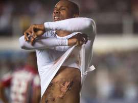 Copete enseña sus quemaduras tras marcar un gol. SantosFC