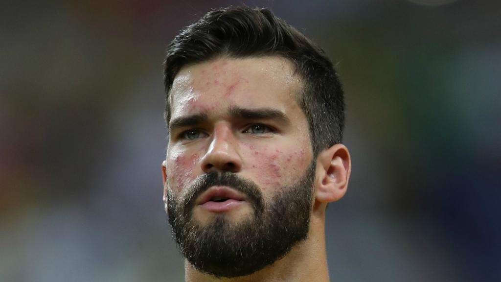 Alison Becker Jokes On Twitter I M Joining Liverpool Besoccer