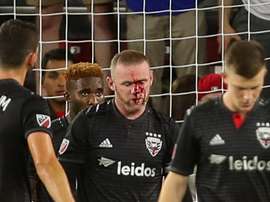 Wayne Rooney suffered a broken nose. GOAL