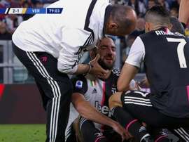 Higuaín assusta com um golpe violento no nariz. Captura/Movistar+
