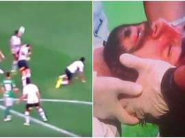 Pratto a perdu conscience. BeSoccer